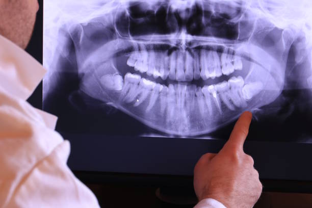Best Walk-In Emergency Dentist in Harbor Beach, MI