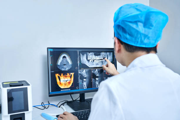 Best Emergency Tooth Extraction in Harbor Beach, MI