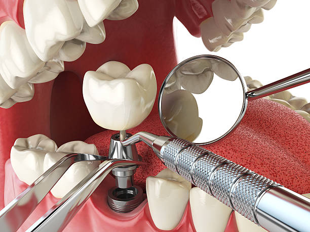 Best Emergency Treatment for Toothache in Harbor Beach, MI